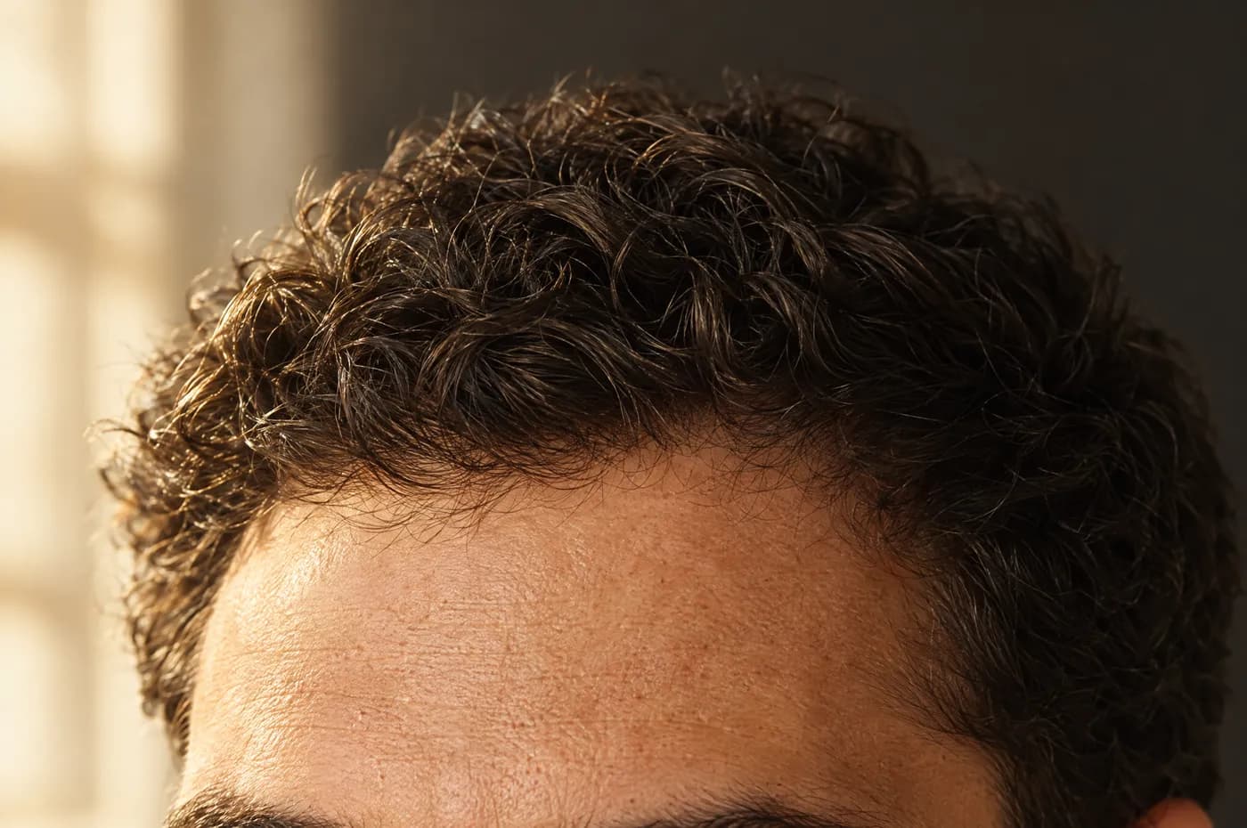 Detalle de una línea frontal de cabello natural e irregular en la frente de un hombre, recortada sin mostrar el rostro