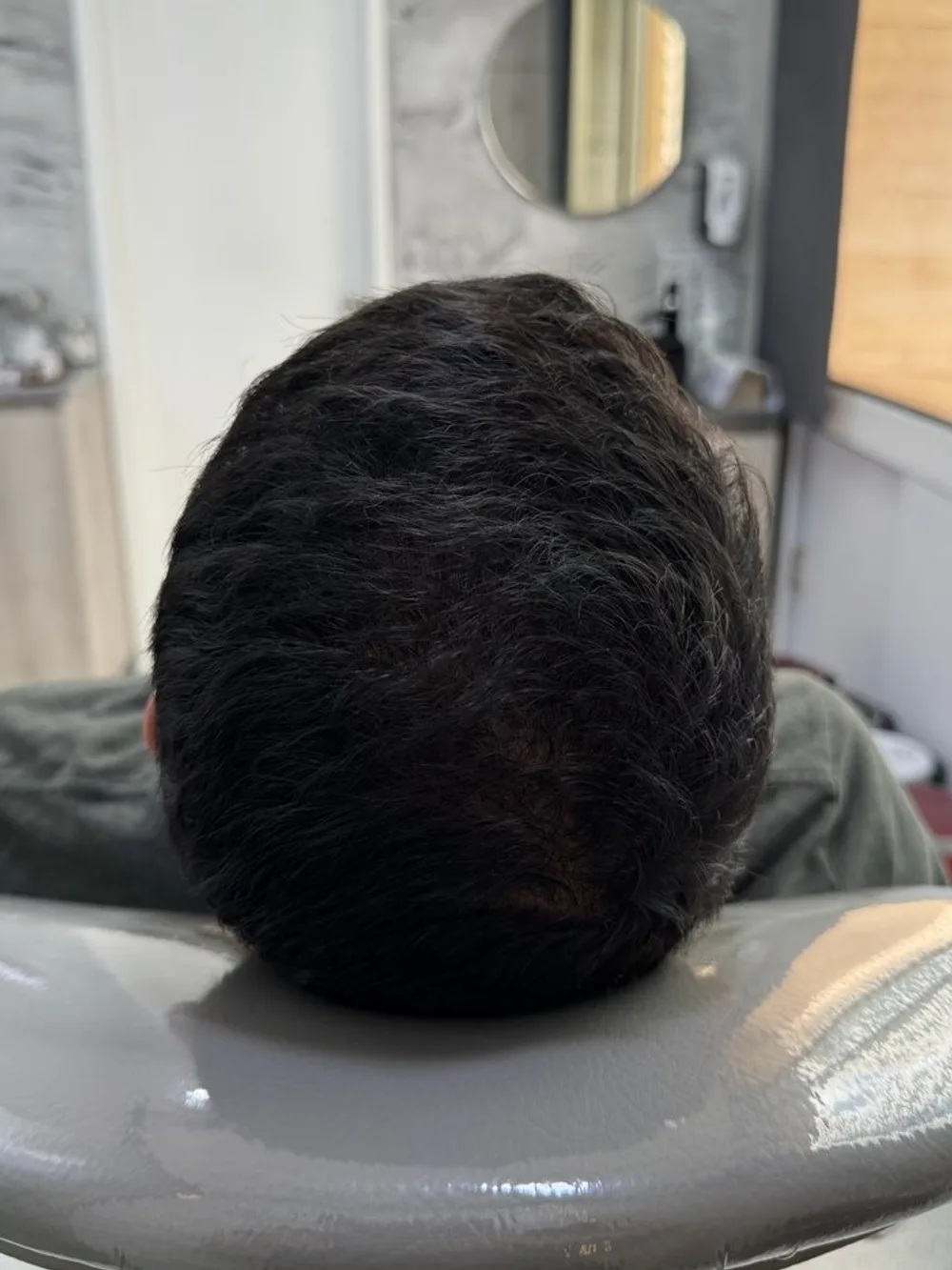 Cabello más denso en la parte superior — después