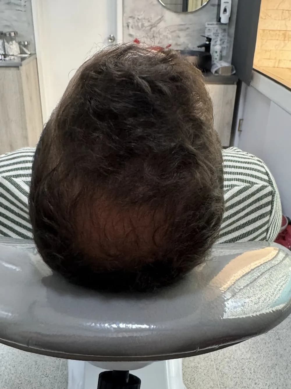 Coronilla con más cobertura — después