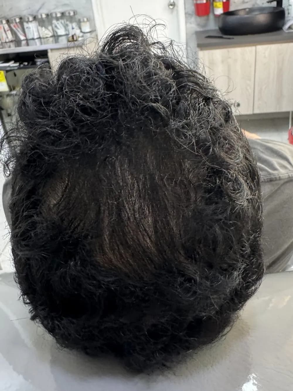 Del claro en la coronilla a un cabello abundante — después