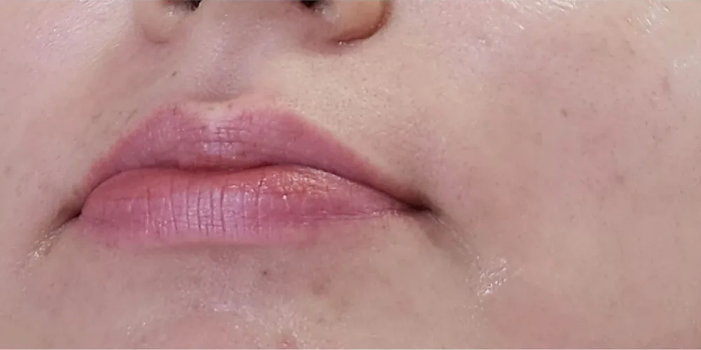 Labios hidratados y definidos — antes