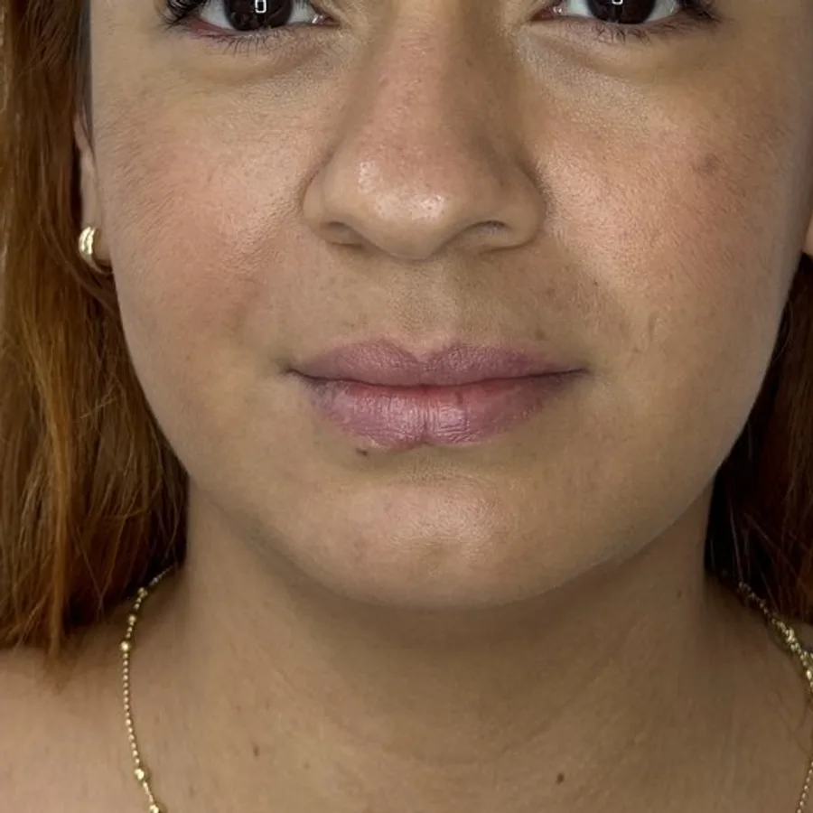 Labios con más definición — antes