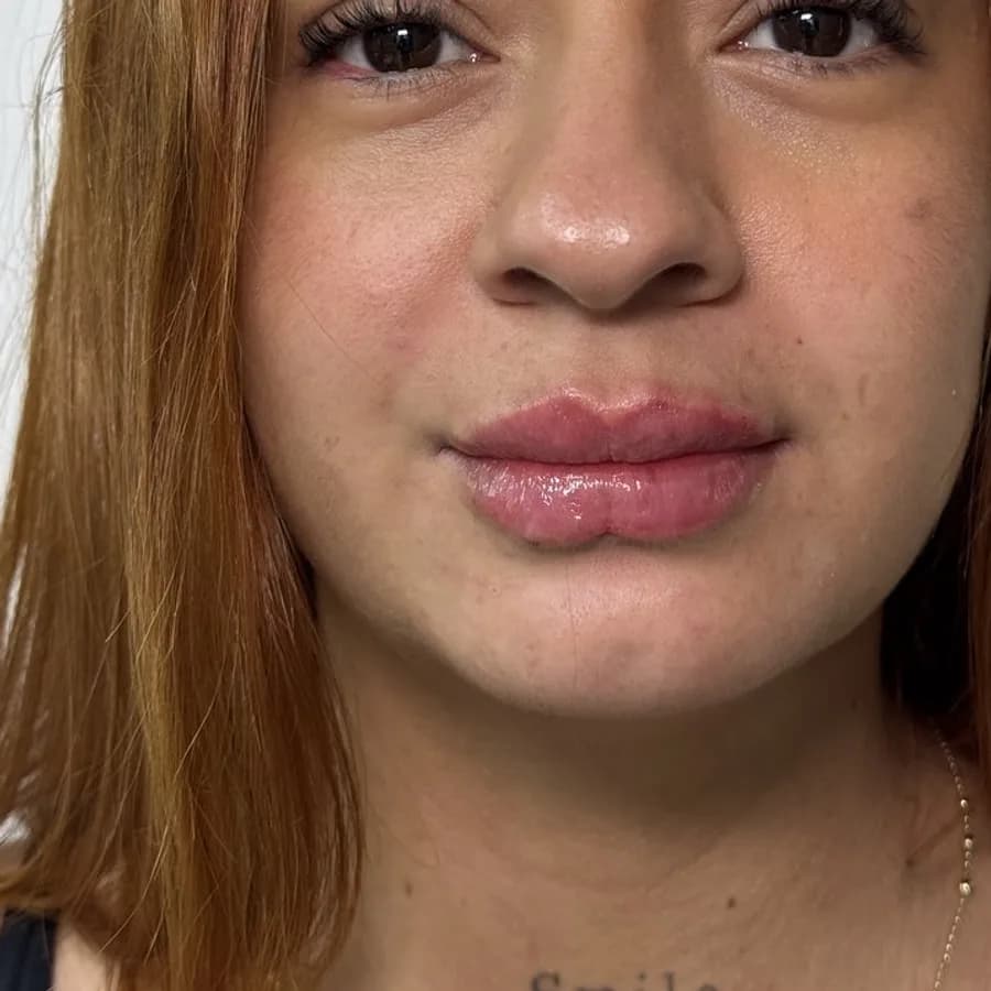 Labios con más definición — después