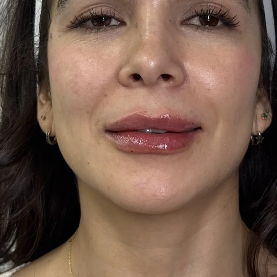 Labios hidratados y con forma — después