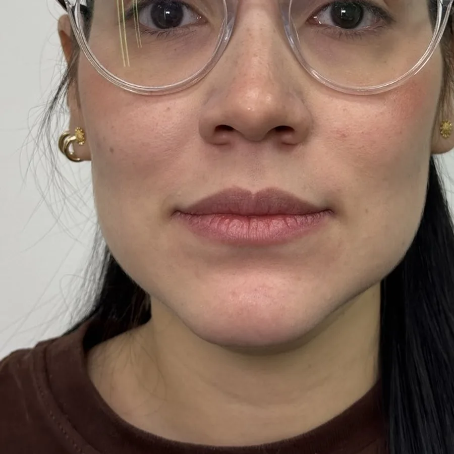 Más volumen, mismo rostro — antes