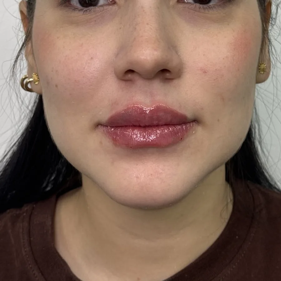 Más volumen, mismo rostro — después