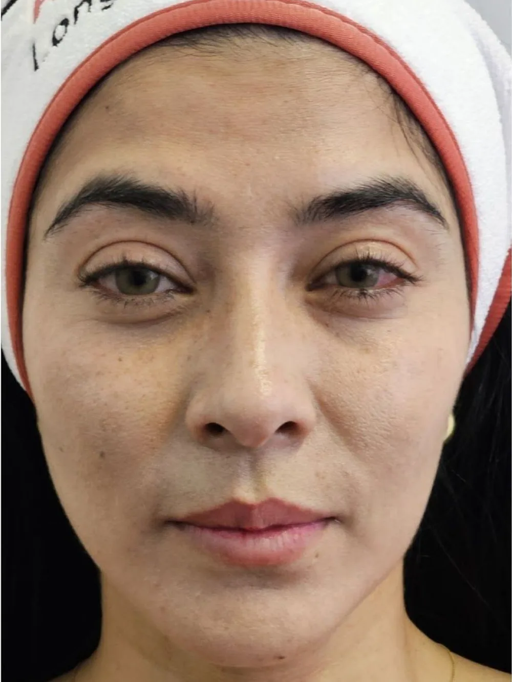 Rostro con soporte y luminosidad — antes