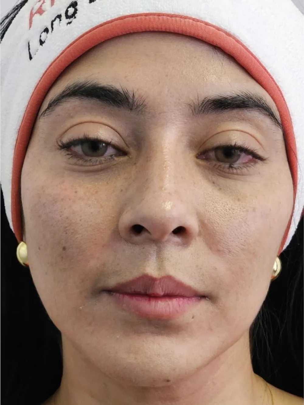 Rostro con soporte y luminosidad — después