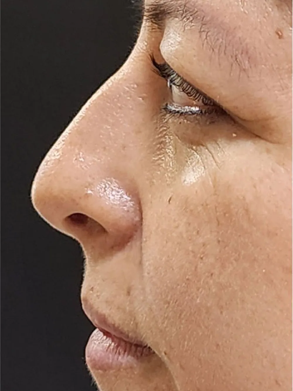 Perfil más suave — antes