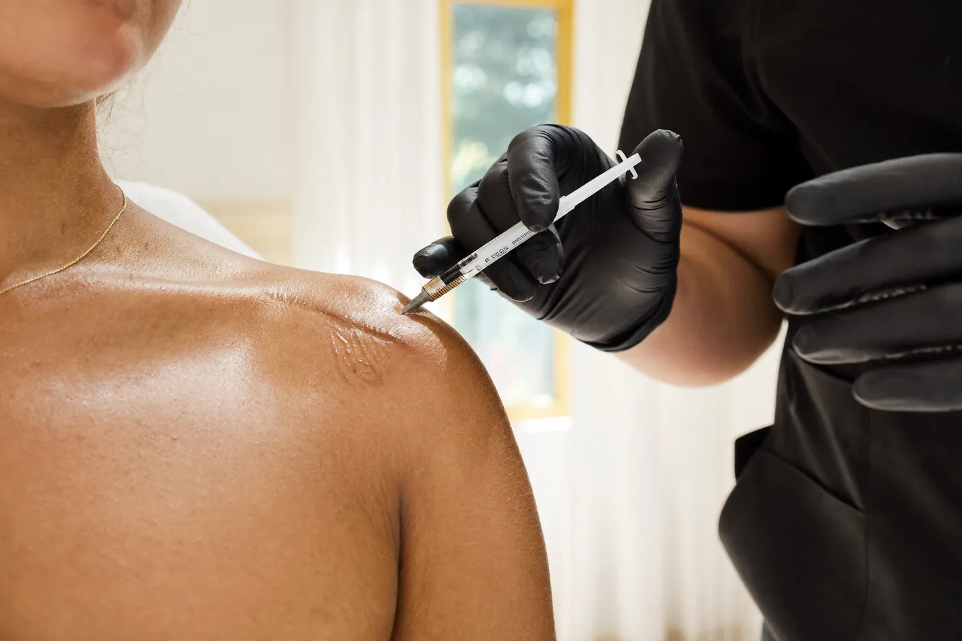 Aplicación de enzimas: Enzimas para cicatrices queloides y fibrosis