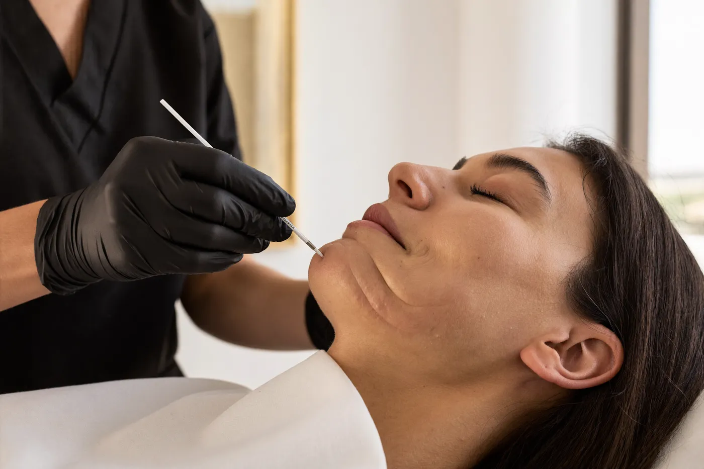 Aplicación del bioestimulador: Tensado facial con hidroxiapatita (Radiesse / Facetem)