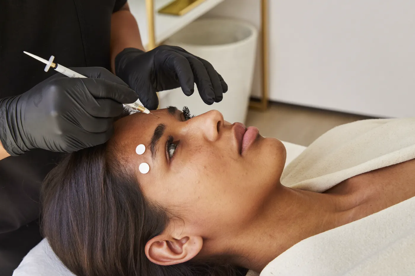Mesoterapia y aparatología: Tratamiento de manchas mesoterapéutico