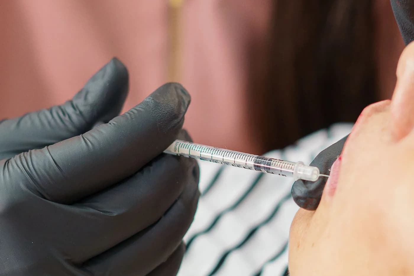 Aplicación a lo largo de la mandíbula: Perfilado mandibular