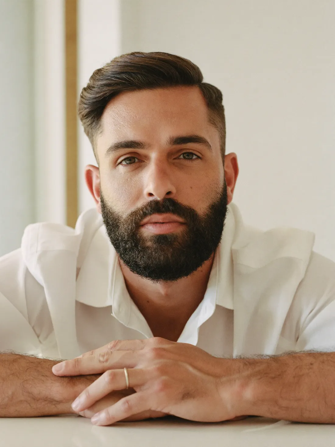 Resultado natural de Trasplante de barba