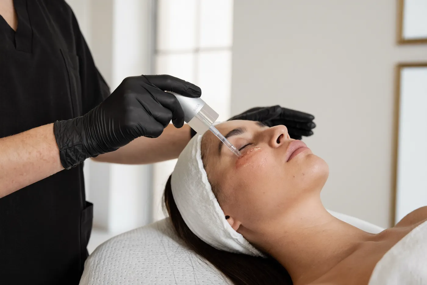 Aplicación de PB Serum: Tratamiento de cicatrices
